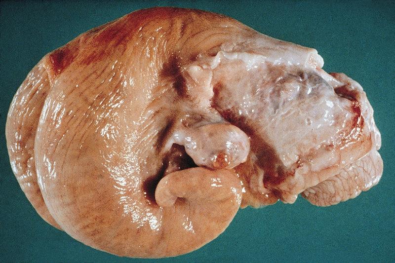 Entdecken Sie die verschiedenen Funktionen, den Aufbau und die Entwicklung der Gebärmutter einer fruchtbaren Kuh.