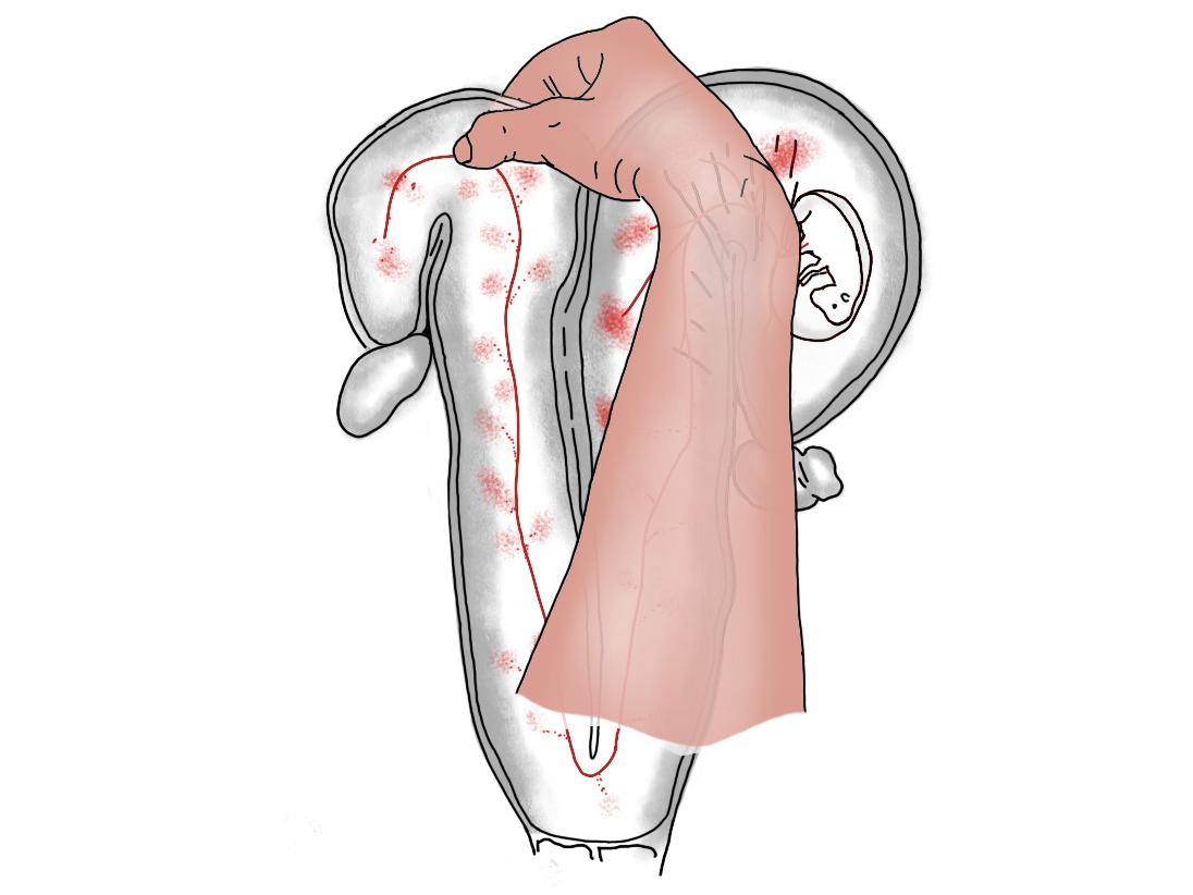 Erfahren Sie, mit welchen Methoden die Trächtigkeit Ihrer Kühe zuverlässig untersucht und bestätigt werden kann..